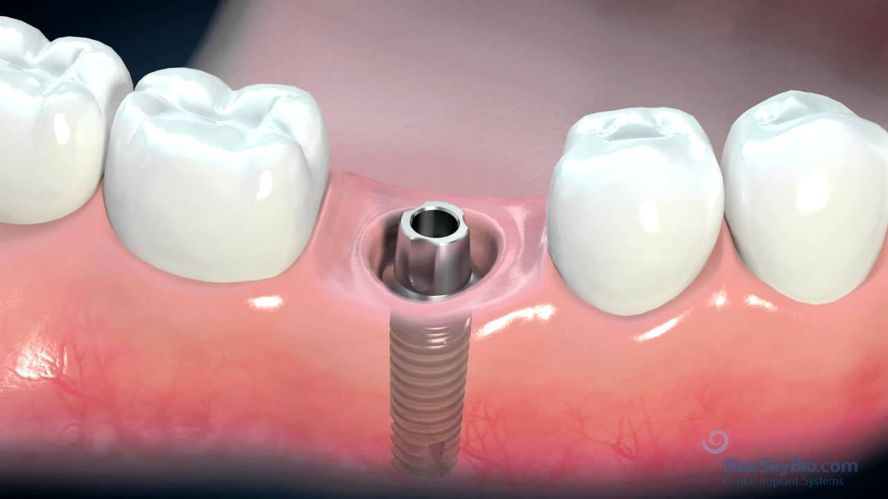 Prosthodontics