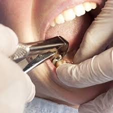 ORAL SURGERY