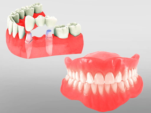 ITS DENTAL COLLEGE ENDODONTICS PROSTHODONTIC